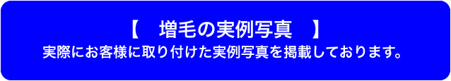 増毛の実例写真バナー